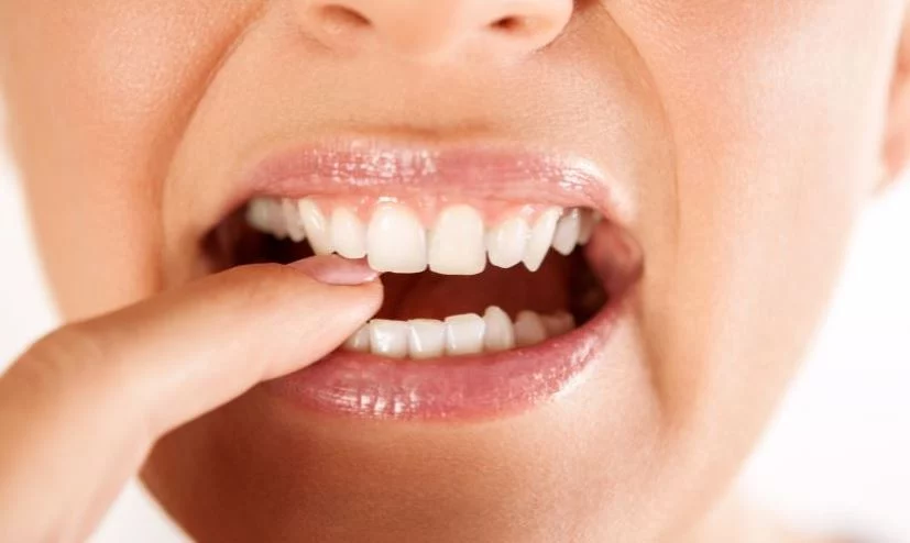 Sigue estos consejos y obtendrás dientes más blancos