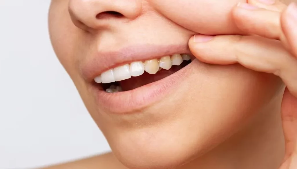 Si deseas tener dientes blancos evita estos alimentos