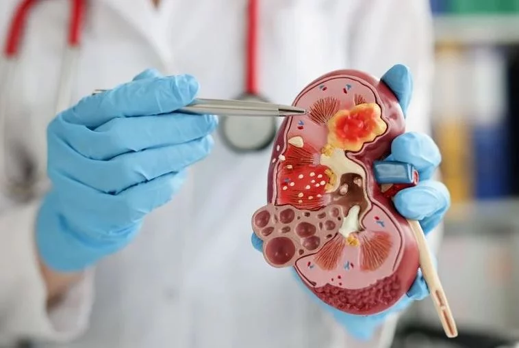 Elimina el dolor de riñones con 3 ingredientes