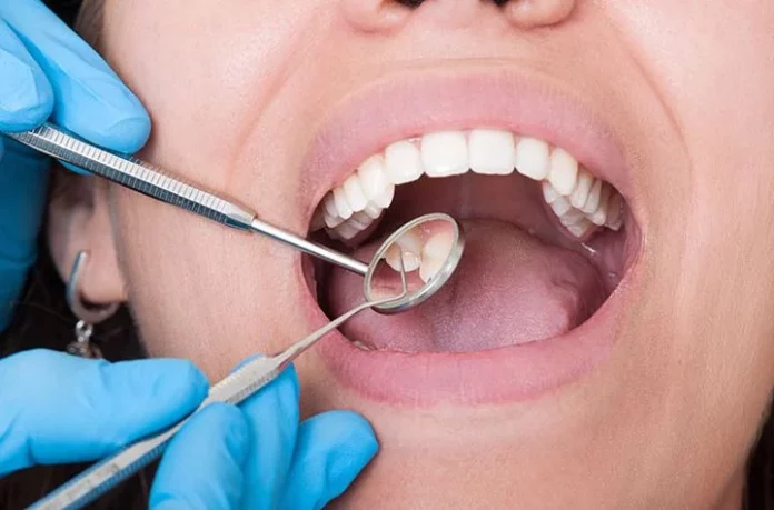 Esta especia es capaz de prevenir la caries dental y combatir el mal aliento