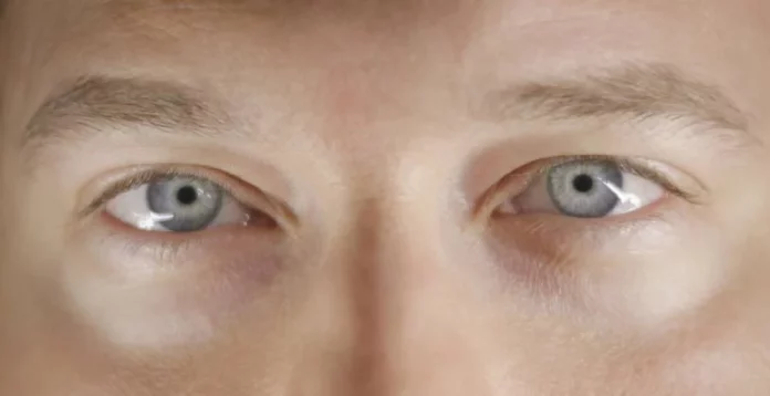 La cirugía más riesgosa del mundo que cambia tu color de ojos y es tendencia