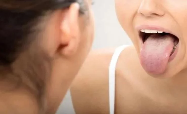Un síntoma en tu boca que podría ser una alerta temprana de diabetes