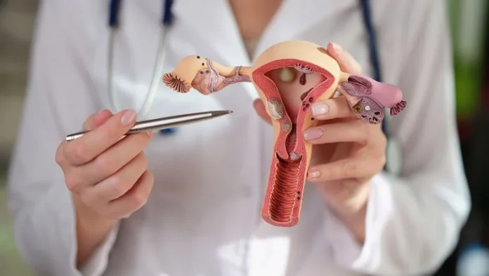 Qué es el SOP y por qué algunos especialistas lo relacionan con la diabetes