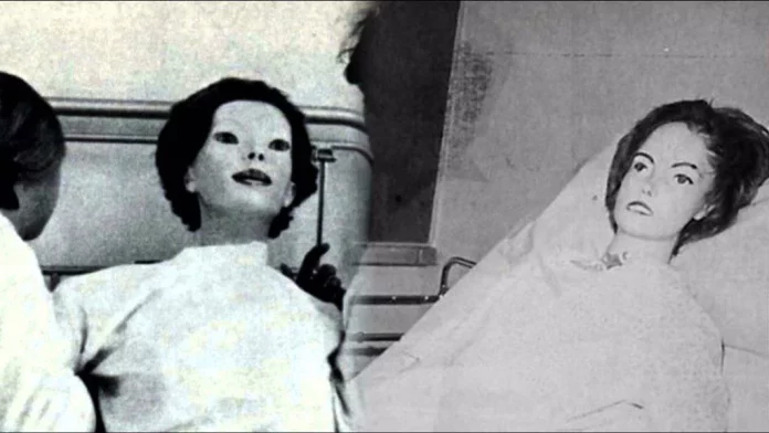 La historia de la mujer maniquí: llegó a un hospital con un horrible aspecto y los médicos descubrieron una terrible condición