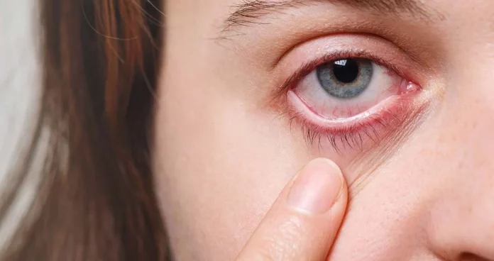 Alerta sobre un reto viral que podría dañar tu visión