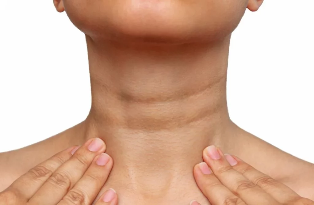 Si tienes esta mancha en el cuello, ve al médico inmediatamente 1 Moncloa ¿Cómo puedo reducir las manchas en el cuello?