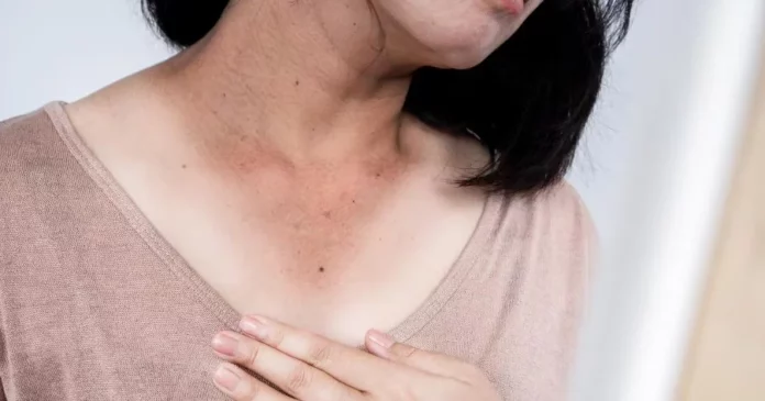 Si tienes esta mancha en el cuello, ve al médico inmediatamente