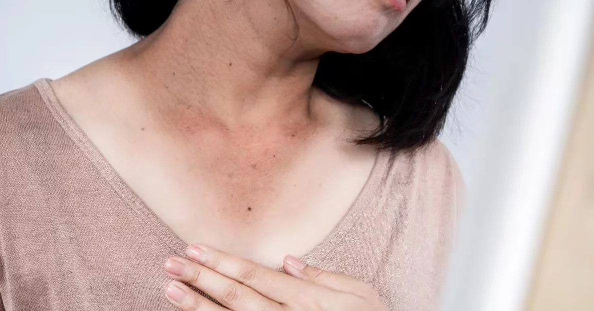 Si tienes esta mancha en el cuello, ve al médico inmediatamente