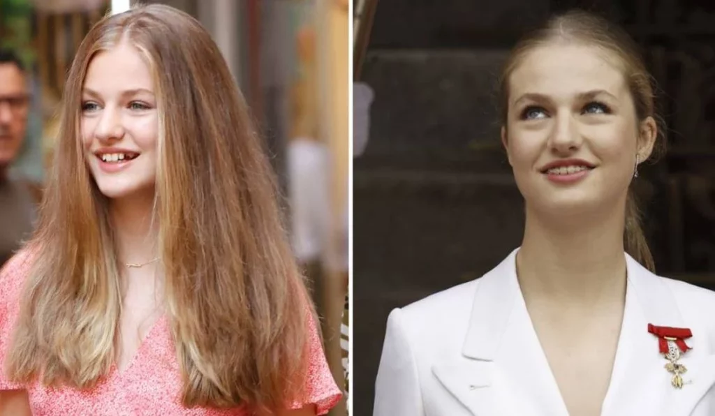 Cuál es la condición genética que la princesa Leonor esconde detrás de su sonrisa 1 Moncloa Así cambió la sonrisa de la princesa Leonor