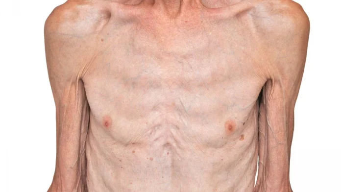 La película de Apple TV que obligó a su protagonista bajar 30 kilos y lucir desnutrido