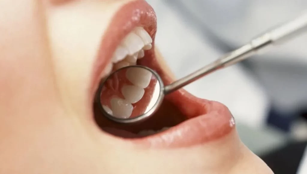 Odontólogos revelan 5 secretos para unos dientes blancos sin sensibilidad que desconocías 1 Moncloa Estos son los secretos para tener dientes blancos