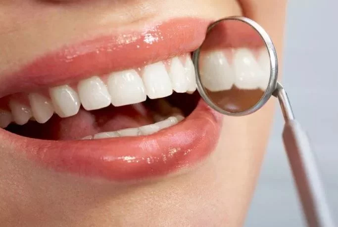Odontólogos revelan 5 secretos para unos dientes blancos sin sensibilidad que desconocías 2 Moncloa Evita la sensibilidad en tus dientes blancos