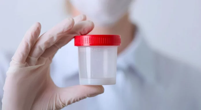 Si tu esperma luce de esta manera podría ser una señal de alarma