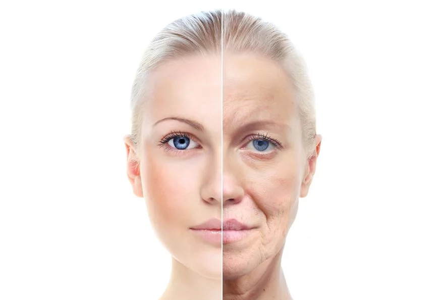 Descubre el lifting facial: qué es y los riesgos que conlleva 1 Moncloa Así funciona el lifting facial