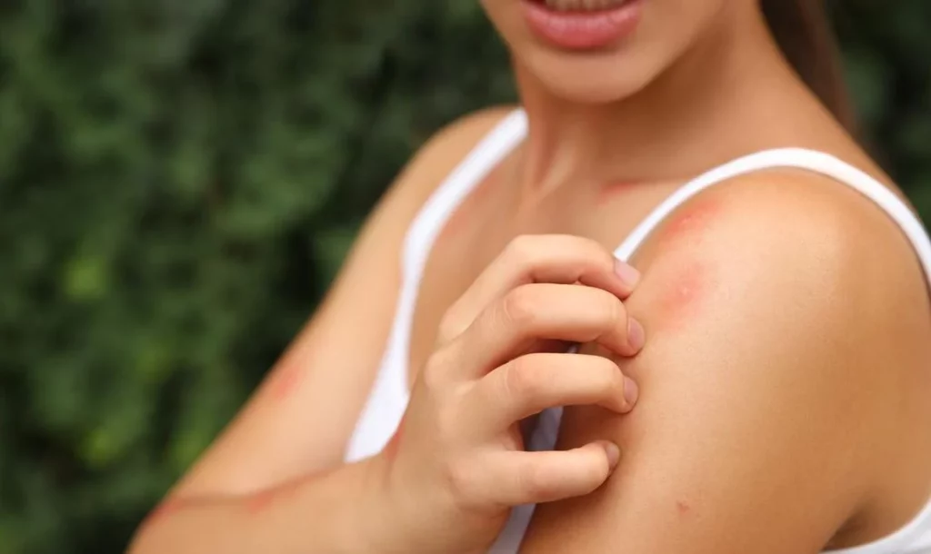 5 plantas que mantendrán tu hogar libre de mosquitos 2 Moncloa Estas son las plantas ideales para ahuyentar mosquitos