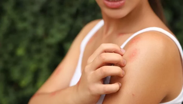 Medusas y mosquitos quedan atrás: descubre la plaga peligrosa que amenaza España