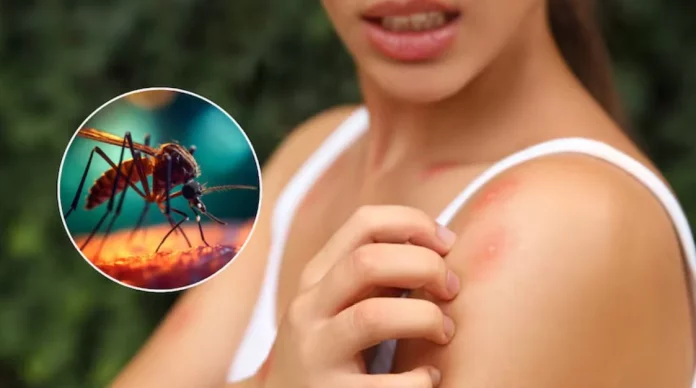 La solución rápida para picaduras de mosquitos está en Mercadona a un precio de regalo