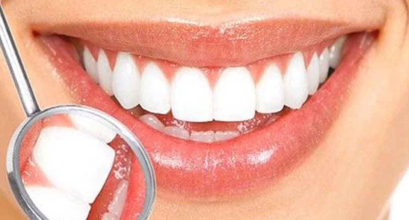 Cepillarte los dientes de esta forma te podría pasar factura y arruinar tu salud 2 Moncloa ¿Qué debo hacer después de comer?