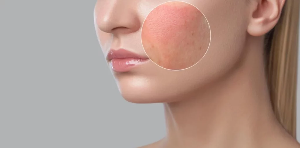 Retiran del mercado este exfoliante tras la alerta de la AEMPS por riesgos 1 Moncloa Por qué este exfoliante es peligroso