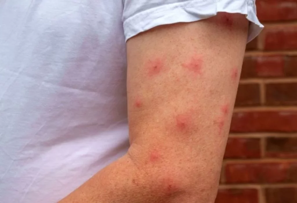 Cómo protegerte del virus del Nilo ahora que se ha vuelto permanente 1 Moncloa ¿Cómo se transmite el virus del Nilo?