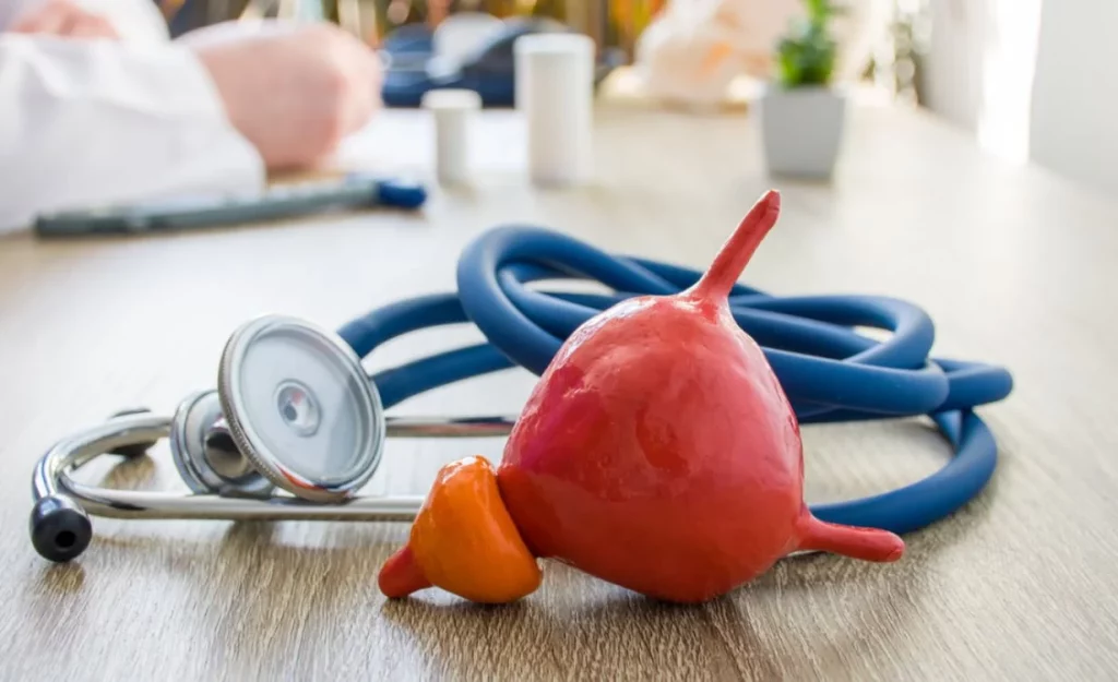 El síntoma del cáncer de próstata que suele ignorarse, pero es clave para un diagnóstico temprano 2 Moncloa Otros síntomas del cáncer de próstata