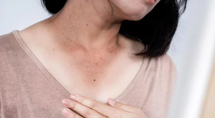 Cómo un simple cambio en tu piel podría indicar diabetes tipo 2