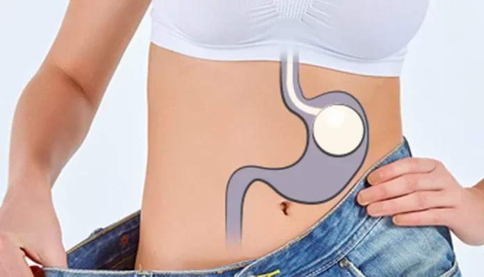 Cómo conseguir un efecto balón gástrico de forma natural y sin cirugías