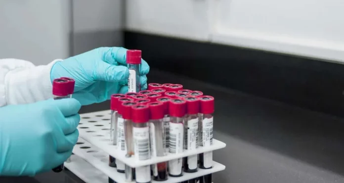 Tres secretos de una enfermera que garantizan una analítica perfecta