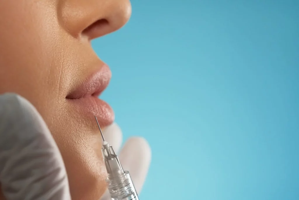 Así funciona el nuevo filtro de TikTok que te advierte como quedarán tus labios si te inyectas 1 Moncloa Detalles que tienes que saber antes de inyectarte botox además del filtro de TikTok