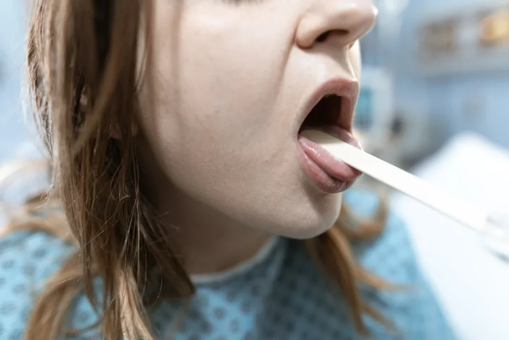 Lo que tu lengua revela sobre tu salud, aunque no quieras verlo 2 Moncloa Otros colores que revelan