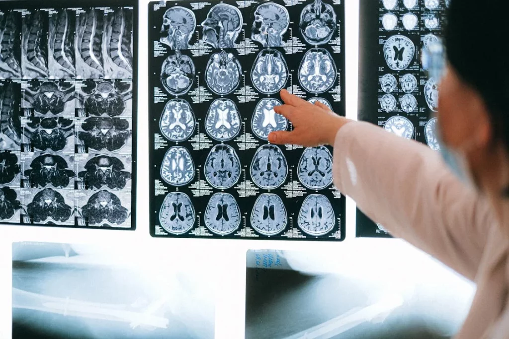 Médicos activan cerebros vacilones y tú puedes ser el siguiente 1 Moncloa No se trata de genética, el cerebro se debe entrenar