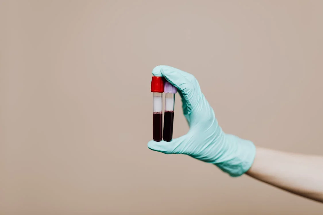 No bajas de peso por esto: los 3 análisis de sangre que tu médico nunca te pide