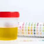 Si tu orina tiene este color, deberías beber agua urgentemente pero si tiene este otro, consulta a un médico