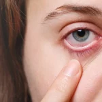 Ese ‘calambre’ que te da en el párpado y que no se va no es por estrés: tu cuerpo te está avisando de que te falta esto