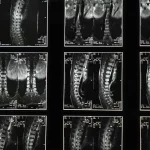 ¿Miedo a la osteoporosis? Estos dos alimentos trabajan en equipo para proteger tus huesos