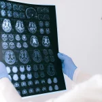 Un solo ingrediente que podrías añadir a tus ensaladas y que favorece la salud cerebral