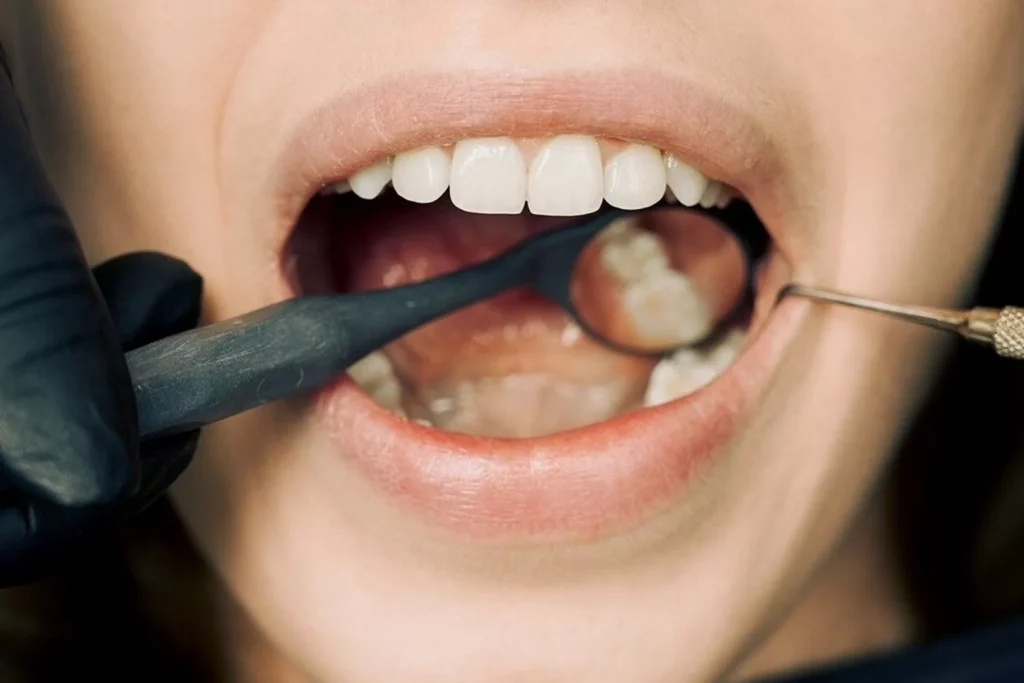 La pasta de dientes que muchos usan en Europa y no es solo por moda 2 Moncloa La importancia de ir al odontólogo