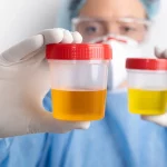 Dr. Ernesto Revuela (59), oncólogo: ‘Este es el primer síntoma del cáncer de páncreas que el 90% de la gente ignora, y después ya es tarde’