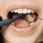 Incluye estos 8 nutrientes a tu dieta o prepárate para perder tus dientes antes de los 40 años