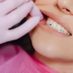Este truco viral promete dientes blancos, pero puede destrozar tu sonrisa sin que te des cuenta