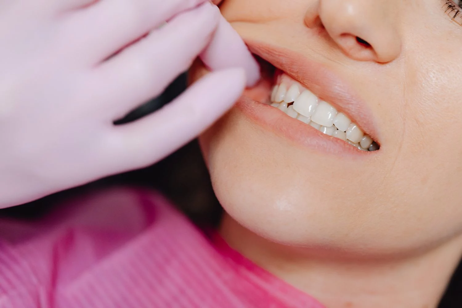Este truco viral promete dientes blancos, pero puede destrozar tu sonrisa sin que te des cuenta