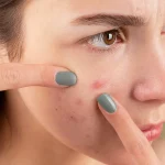 ¿Problemas hormonales? Tal vez no es tu cuerpo, sino lo que estás poniendo en tu plato