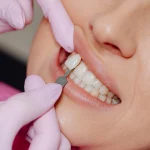 Rebecca Soler (33), odontóloga: “El aceite de coco blanquea los dientes y con este ingrediente rivaliza con tratamientos caros”
