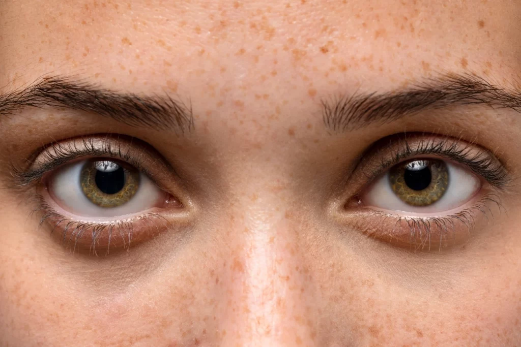 Según ChatGPT, este color de ojos tiene más riesgo de enfermedad ocular: Hay un 60% de posibilidades de que sea el tuyo 1 Moncloa Separando la curiosidad tecnológica de la realidad médica para evitar alarmas innecesarias. Fuente: Freepik